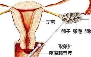 预示试管移植成功的征兆都有什么