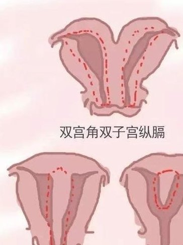 试管促排第10天内膜5mm正常吗？不同促排方案第10天内膜厚度