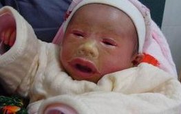 试管婴儿囊胚质量等级的具体标准是什么？试管婴儿囊胚培育时可以将囊胚分为哪几个时期？