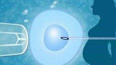 还问试管婴儿前为什么要吃避孕药？赴美前这可是必修课