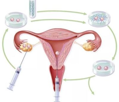 郴州第三代试管婴儿机构成功率